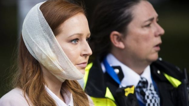 Una mujer con una venda en la cara